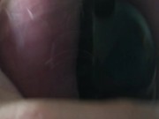 Teen Chastity  Strains and Struggles to Escape Cage