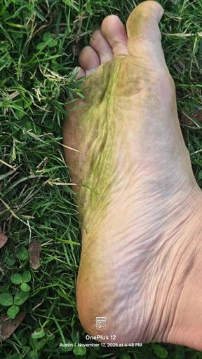 Grounding in Grassy Nature