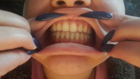Dirty pervert shows you her dirty yellow teeth - teeth fetish