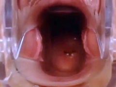 Webcam Pussy Play with Speculum