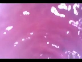 POV Extreme Deep Anal Examination!