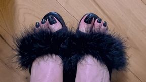 Feet & Black Toenails toes