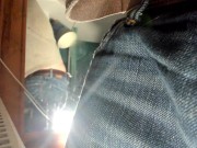 foreskin standing there