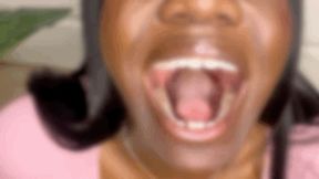 Whipped Cream Spitting