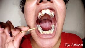 Cloud of bad breath and lots of plaque on my teeth (close-up)