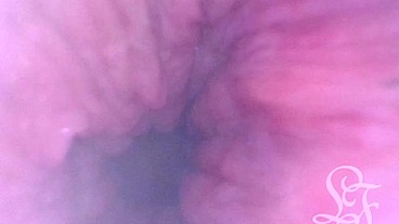 POV Extreme Deep Anal Examination! 📷🍑