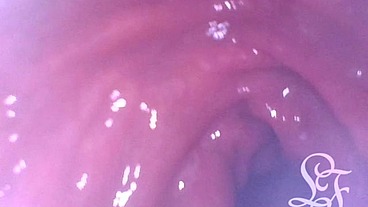 POV Extreme Deep Anal Examination! 📷🍑