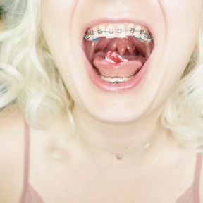 BRACES fetish: ASMR video of eating MUKBANG..