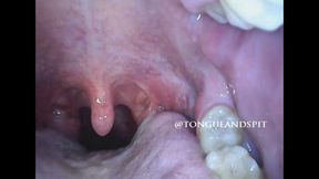 Logan Endoscope Mouth Part21 Video1 - MP4