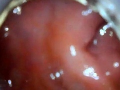 anal endoscope ass play from inside