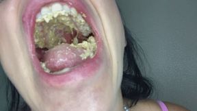 Teeth vs. Wafer Candy: Mega Crunch!