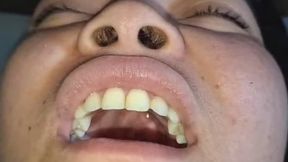 Gargling for long minutes with water stuck in my throat