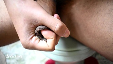 Penis with foreskin