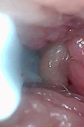 Visual Guide to G-spot Stimulation and Orgasm - Endoscopic Perspective