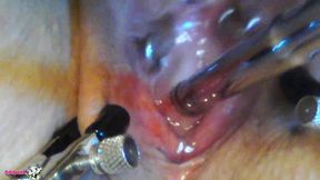 adalynnx - telling you how i love to sound my holes