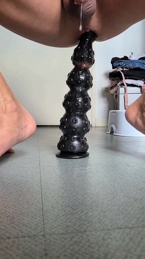 Dilatation Anal Xxl