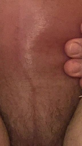 Memorable moment from &quot;Glucose  Saline pic compilation&quot;