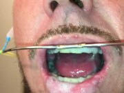 self facial on my braces and play with my cum