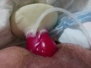 Knotting paraplegic ass