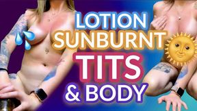 Rubbing Lotion on My Big Sunburn Tanline Tits and Body