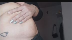 Stretch marks on a fat belly: your new obsession in close-up