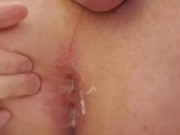 Anal Play, Gape, Dildo - 9