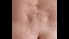 Kalle mit 2 dicken Knubbels die einen Durchmesser von 10cm haben