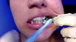 Brushing My Teeth and Showing You My Teeth (close-up)