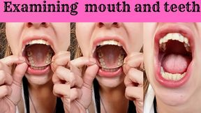 Close-Up of My Real Mouth: Crooked Teeth and Cavity-Ridden Molars