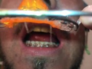 New Braces retainer and Twinblock with headgear for new aventures