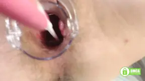Laugh-out-loud gyno exam with speculum close up in hairy pussy&#x1F32E;&#xFE0F;