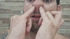 Snotty nostrils