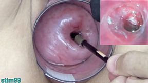 Japanese mature milf's cervix gets ravished by probes in a 69ing uterus exploration