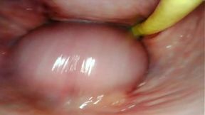 AMAZING INTERNAL POV CAMERA INSIDE HER PUSSY WHILE I FILL HER WITH CUM