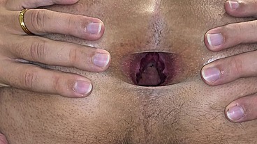 Mostrando cuzinho arrombado 4