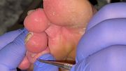 Ugly Feet Pedicure ASMR