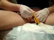 Removal catheter