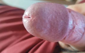 The Blossoming of Extensive Elastic Phimosis.