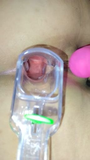 Especulo anal