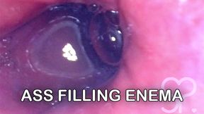 POV Dive Into Lina&#039;s Clean Ass! (Enema Minicam) - Full Video on Fansly and Manyvids
