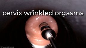 cervix wrinkled orgasms - uncaptioned