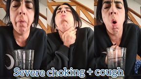 Severe choking + cough
