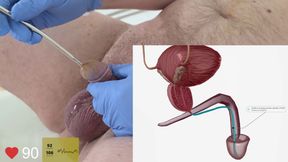 Second time trying urethral sounding and reviewing anatomy