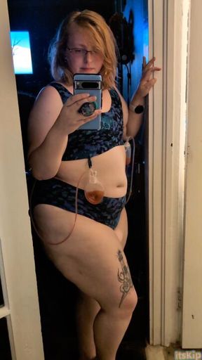 After surgery progress • Week 2 & 3 uncensored