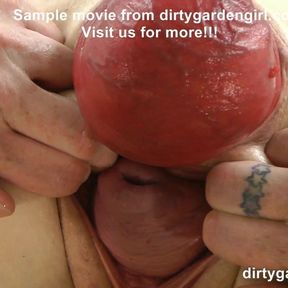 Dirtygardengirl extreme balls insertions and prolapse