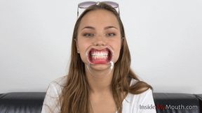 Inside My Mouth - Maria - Mouth retractor insertion! (FULLHD quality)