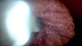 Endoscope Camera Shows the Most Sensitive Parts of the Penis Educational Video