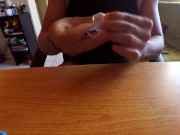 El uso de retenedores en la restauracion del prepucio