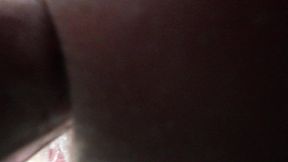 anal prolapse in barbershop!