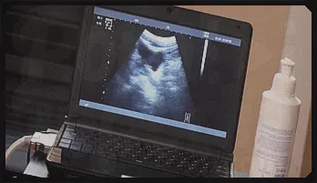 Doctor's Prostate Exam: A Fun-Sized Twink's Delight